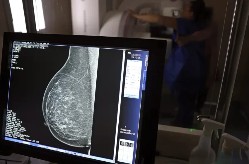  Câncer de mama: uma em cada três pacientes tem menos de 50 anos