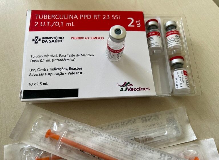  Exame para detectar tuberculose já está disponível em 14 locais, anuncia Secretaria de Saúde