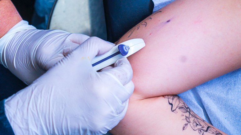  Paraíba capacita profissionais de saúde para ampliar oferta de implante contraceptivo em 11 municípios
