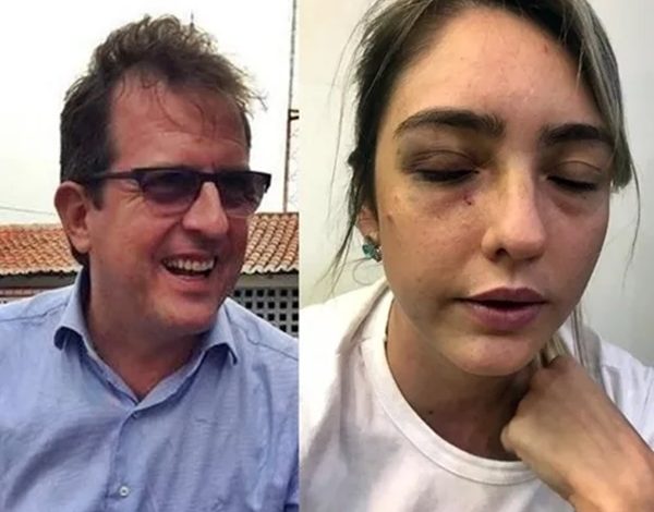  STJ mantém condenação de ex-prefeito de Sousa por agressão a ex-namorada