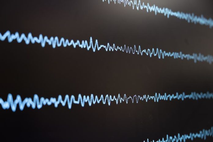  Terremoto de magnitude 5,9 atinge a Ilha Sul da Nova Zelândia; alerta de tsunami é cancelado